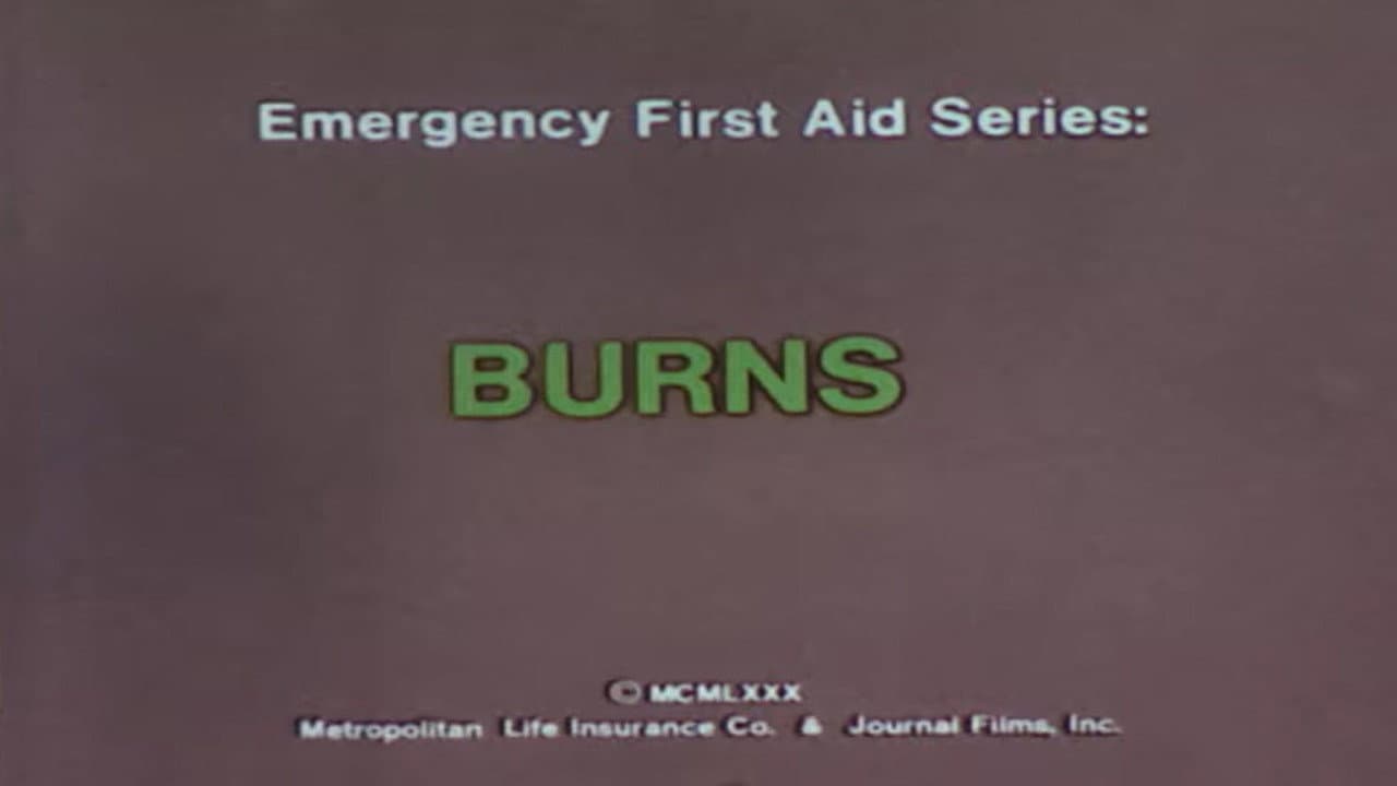 Emergency First Aid Series: Burns backdrop