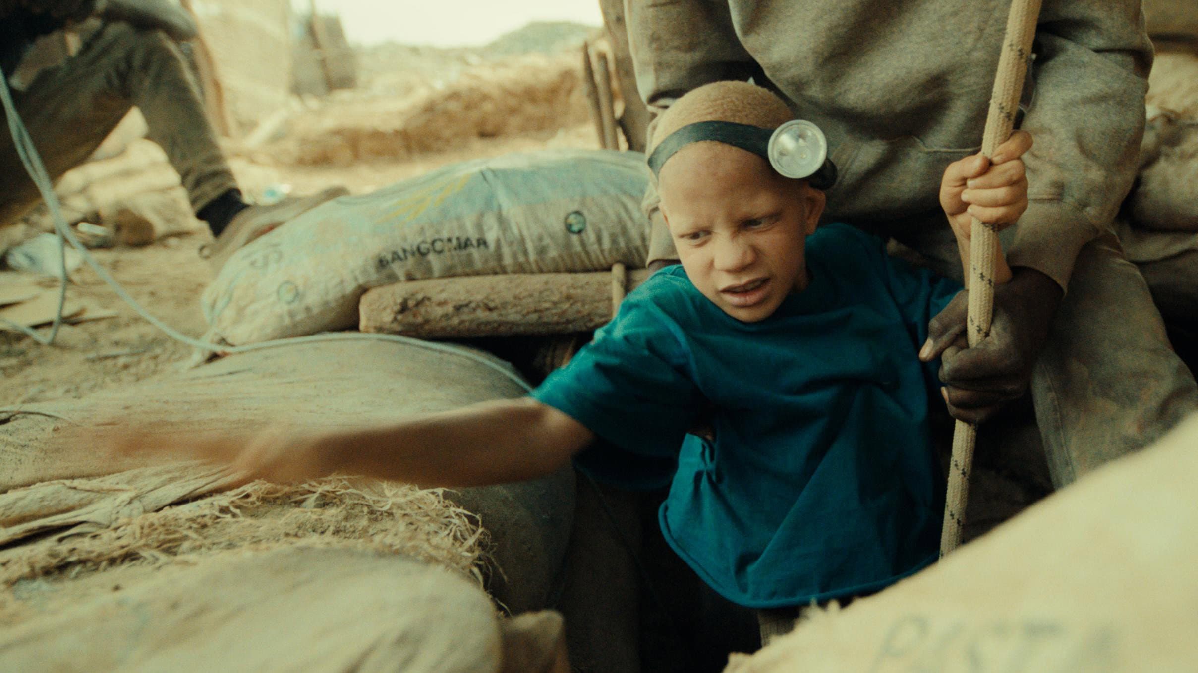 The Boy with White Skin backdrop