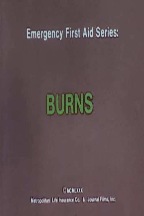 Emergency First Aid Series: Burns poster